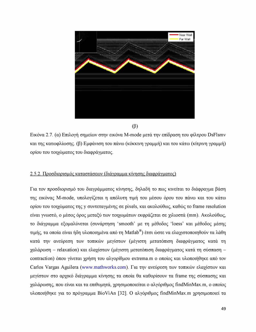 (β) Εικόνα 2.7. (α) Επιλογή σημείων στην εικόνα M-mode μετά την επίδραση του φίλτρου DsFlsmv και της κατωφλίωσης.