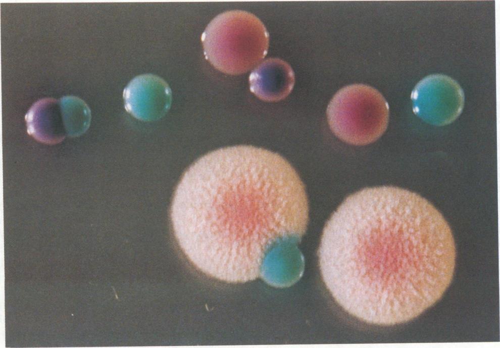 glabrata ροζ, δύο C. tropicalis μπλε-μωβ και δύο μεγάλες, ελαφρώς ροζ και αδρές C. krusei ( Odds FC, Bernaerts R 1994). 3.