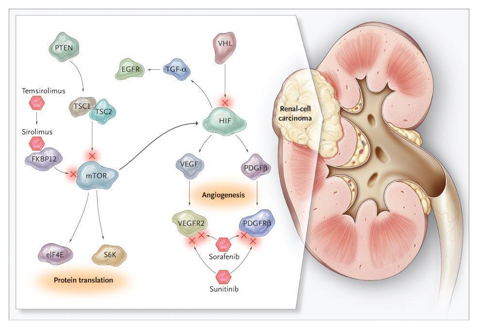 Molecular Pathways and Targeted Therapies in