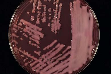 Asaia spp Methylobacterium spp Roseomonas and Azospirillum spp Acinetobacter spp.