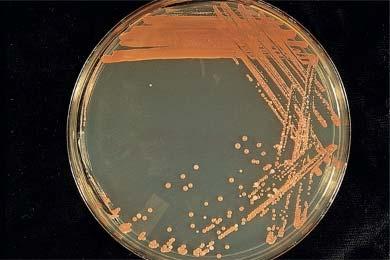 species Gilardi Rod Group 1 Sphingobacterium and Pedobacter CDC Group EF-4b Paracoccus yeei (EO-2), CDC Groups EO-3, EO-4 Psychrobacter immobilis Achromobacter xylosoxidans Ochrobactrum Species