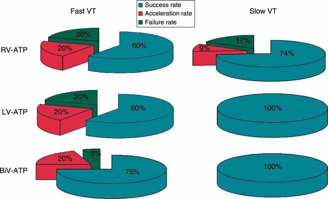 Different ATP Sites in the termination of VT in