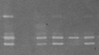 1 2 3 4 5 6 prommp-9 (92.0 kda) MMP-9 (78 kda) prommp-2 (72.0 kda) MMP-2 (64.0 kda) Σχήμα 2: Επίδραση αναστολέων πρωτεασών στη ζελατινολυτική δραστηριότητα.