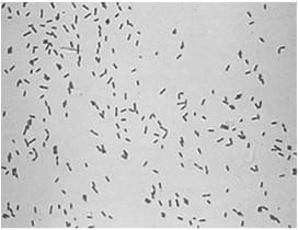 Serpens Sinorhizobium Sphingobacterium Thermoleophilum Thermomicrobium Thermus Variovorax Volcaniella Weeksella Xanthobacter Xylella Xylophilus Zoogloea