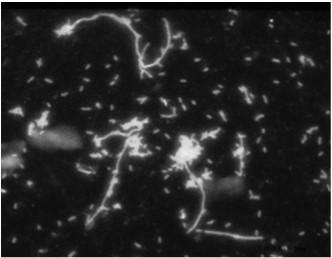 pseudomallei, προκαλούν συγκεκριμένες ασθένειες όπως η νόσος των αλόγων και η μελιοείδοση. Η P.