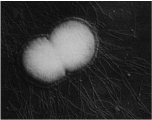 gonorrhoeae, που προκαλεί τη βλεννόροια, και το N.