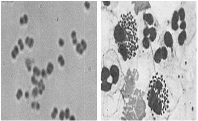 gonorrhoeae έχουν μεγάλη διάδοση και μικρή θνησιμότητα ενώ αυτές του N.