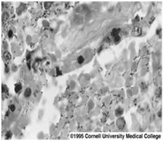 Escherichia Ewingella Hafnia Klebsiella Kluyvera Leclercia Leminorella