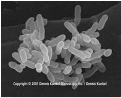Providencia Rahnella Salmonella Serratia Shigella Tatumella