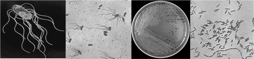 Escherichia Παθογόνα στελέχη Escherichia coli Ορότυποι μη ETEC Τα στελέχη E.