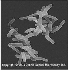 Shigella sonnei Αποικίες σε άγαρ Οι Shigellae είναι Gram-αρνητικοί,