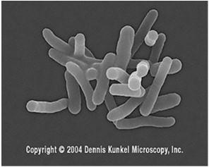 Διαφοροποιούνται από το Escherichia coli με βάση τη παθογένεια και τη
