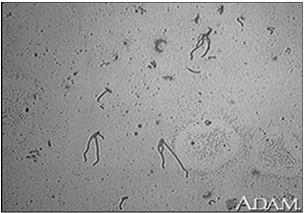 Yersinia Yersinia enterocolitica Yersinia pestis Η Yersinia pestis προκαλεί τη βουβωνική και πνευμονική πανώλη.