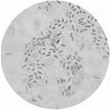 Vibrio Vibrio cholerae Vibrio parahaemolyticus Vibrio vulnificus Τα Vibrios είναι πολύ διαδεδομένα βακτήρια σε στάσιμα νερά και σε θαλάσσιους οργανισμούς. Τα είδη V. cholerae και V.