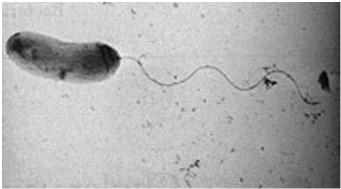vulnificus το οποίο προκαλεί γαστρεντερίτιδα και ένα σύνδρομο που ονομάζεται «πρόωρη σηψαιμία».
