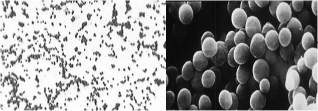 Peptostreptococcus Ruminococcus Sarcina Gram-θετικοί κόκκοι Staphylococcus Staphylococcus aureus Staphylococcus aureus Staphylococcus epidermidis Οι Staphylococci είναι Gram-θετικοί κόκκοι διαμέτρου