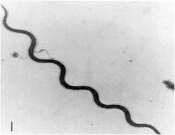 Τάξη Spirochaetales Borrelia Borrelia hispanica Borrelia burgdorferi Η Borrelia είναι ευκίνητη, σπειροειδής, Gram-αρνητική σπειροχαίτη με εσωτερικό μαστίγιο.