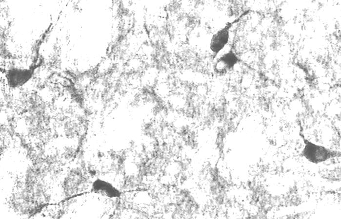 Ράβδος=100µm (Α, Γ), 50µm (Β, ). 5.2.