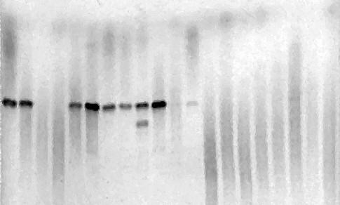 Κεφ. 4. Tαυτόχρονη ανίχνευση Clostero-, Fovea- και Viti-ιών Για την αποτελεσματική ανίχνευση απομονώσεων του GLRaV-3 ήταν απαραίτητη η προσθήκη 5% DMSO στην RT-PCR (Εικόνα 4.