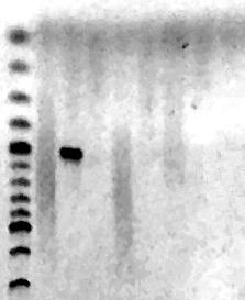 1 2 3 4 5 6 7 8 9 10 11 12 13 14 15 16 17 18 19 20 500 ζβ DMSO 6% ΔείκτηςΜΒ DMSO 5% DMSO 4% DMSO 3% DMSO 2% ανά 100 ζβ Εικόνα 4.