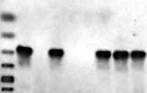 ΚΕΦ. 5 Xαρακτηρισμός ενός νέου Clostero-ιού Οι εκκινητές LR9 εστ π1 και LR9 εστ κ2 που σχεδιάστηκαν, ανιχνεύουν εξειδικευμένα τον νέο clostero-ιό, αφού οι δοκιμές PCR δεν έδωσαν προϊόντα με