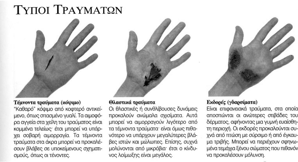 ΜΑΘΗΜΑ 3 Ο ΤΡΑΥΜΑΤΑ &