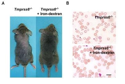 Tmprss6 -/- ποντίκια και IRIDA (Iron Refractory Iron Deficiency Anemia) IRIDA Υπόχρωμη μικροκυτταρική αναιμία