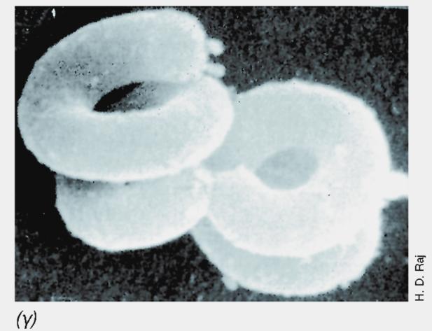 31: (α) To Spirillum volutans, όπως φαίνεται με μικροσκόπιο σκοτεινού πεδίου- διακρίνονται οι δέσμες μαστιγίων και τα κοκκία βολουτίνης (πολυφωσφορικού). Τα κύτταρα έχουν μέγεθος 1,5 x 2,5 μm περίπου.