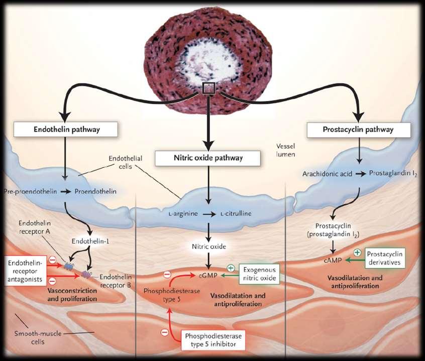 NEJM 2004