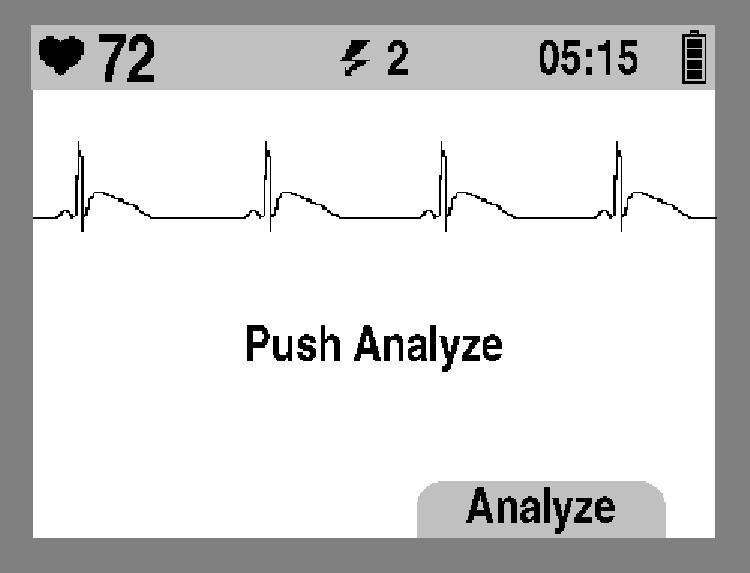 Krmilniki in kazalniki Kazalnik sunka Kazalnik srčnega utripa Območje za sporočila Stanje baterije znak Pretečen čas EKG Opozorila Vstop v ročni način?