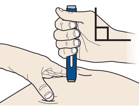 Ή Μέθοδος τσιμπήματος Ανασηκώστε το δέρμα σταθερά μεταξύ του αντίχειρα και των δακτύλων σας δημιουργώντας μια περιοχή πλάτους 5 εκατοστών.