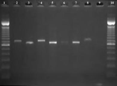 4 Tsakogiannis et al. Fig. 1. Agarose gel electrophoresis of amplified fragments from the 5 0 end of E1 gene in seven cervical samples.