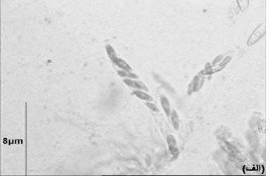 . DNA multiplex PCR MAT-1.( ) G.