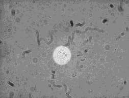 Kriptokokne okužbe so redkejše vstopno mesto so pljuča, lahko sledi hematogeni razsoj najpogostejša in najnevarnejša je okužba OŽ koža, kosti, sečila pri kožni kriptokokozi moramo