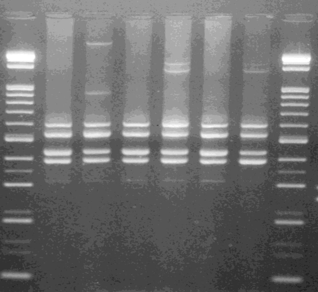 VNTR Η2-ζηει Η3-ΓΚΤ