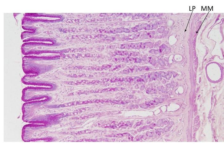 19 Βλεννογόνος στομάχου (χρώση αιματοξυλίνης-ηωσίνης x10) LP: χόριο (lamina propria), MM: βλεννογόνιος μυικός χιτώνας (muscularis