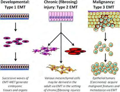 transition). Αυτός ο μηχανισμός επιφέρει μοριακές διεργασίες και μεταβολές στην επιφάνεια των επιθηλίων κυττάρων, μετασχηματίζοντάς τα σε κύτταρα μεσεγχυματικού τύπου.