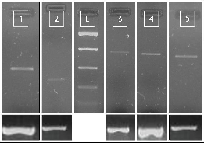 Αποτελέσματα των αντιγόνων MAGE 1: PNAGE T (MAGE-A1, 421bp) 2: PPOVA T (MAGE-A2, 230bp) 3: PEVEV T (MAGE-A3, 725bp) 4: PGEGE T