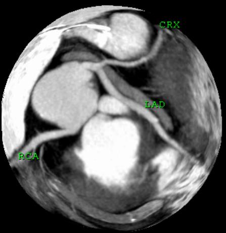 CARDIAC CT: The