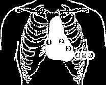 V 4 (κεηαμχ πιεπξψλ 5 θ 6) 9. V 5 (νξηδφληηα ηνπ V 5 ) 10. V 6 (νξηδφληηα ησλ V 4 θαη V 5 ) Εικόνα 3.