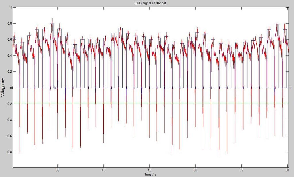 for j = 2: length(m(:,1)); if M(j-1,5)==1 && M(j,5)==2 M(j,5)=1; end; end; Παξαδείγκαηα: