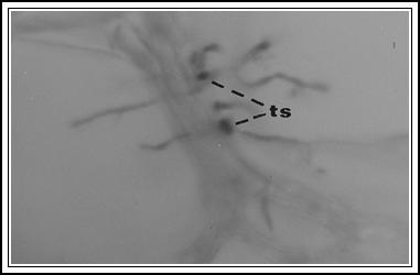 , 2004). Η ανάπτυξη του V. dahliae στο στάδιο αυτό, φαίνεται πως είναι το αποτέλεσμα μιας επάλληλης εξάπλωσης και αποκλεισμού του μύκητα από την δράση της άμυνας του φυτού (Heinz et al.