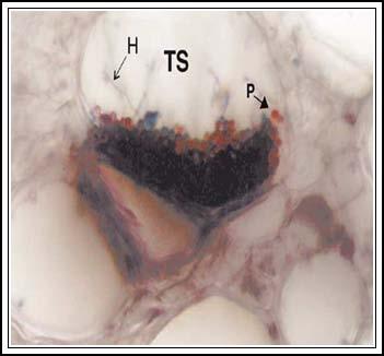 4: Ο μύκητας σε 2-4 ημέρες μετά τη μόλυνση έχει εγκατασταθεί στα αγγεία του ευαίσθητου ξενιστή (Α), σε μία ακόμη ημέρα έχει περάσει στα συνοδά κύτταρα των αγγείων (Β).