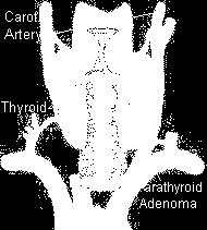 htm two parathyroid