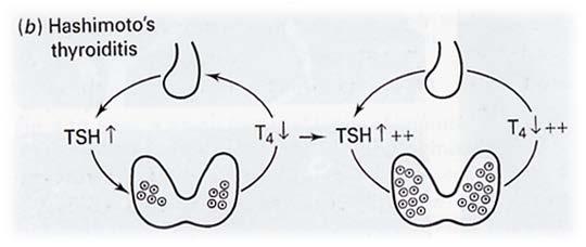 Στα αρχικά στάδια θυροξίνης (T4) TSH διεγείρει τα εναπομείναντα θυρεοειδικά ενδοθηλιακά κύτταρα υπερπλασία (βρογχοκήλη) παραγωγή επαρκών ποσών θυροξίνης για