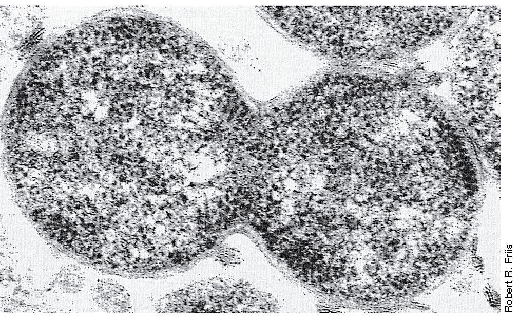 CHLAMYDIA PSITTACI Εικόνα 12.84: Ηλεκτρονιακό μικρογράφημα λεπτής τομής διαιρούμενου κυττάρου (δικτυοσώματος βλ. Εικόνα 12.85) του Chlamydia psittaci, που προκαλεί ψιττάκωση.