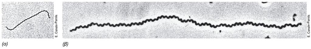 ΦΥΛΟ 10: ΣΠΕΙΡΟΧΑΙΤΕΣ Spirochaeta, Treponema, Cristispira, Leptospira, Borrelia Gram -, αυτοκινούμενα σπειροειδή βακτήρια υδάτων και ζώων Σύφιλη Εικόνα 12.
