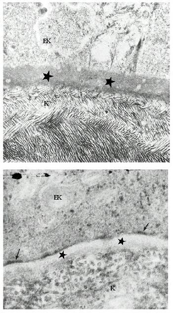 ΒΑΣΙΚΗ ΜΕΜΒΡΑΝΗ επιθηλιακά κύτταρα Κερατοειδής σαλαμάνδρας: ΒΜ (300nm) Ίνες κολλαγόνου