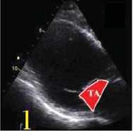 Echo assessment of