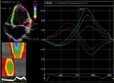 Echo assessment of